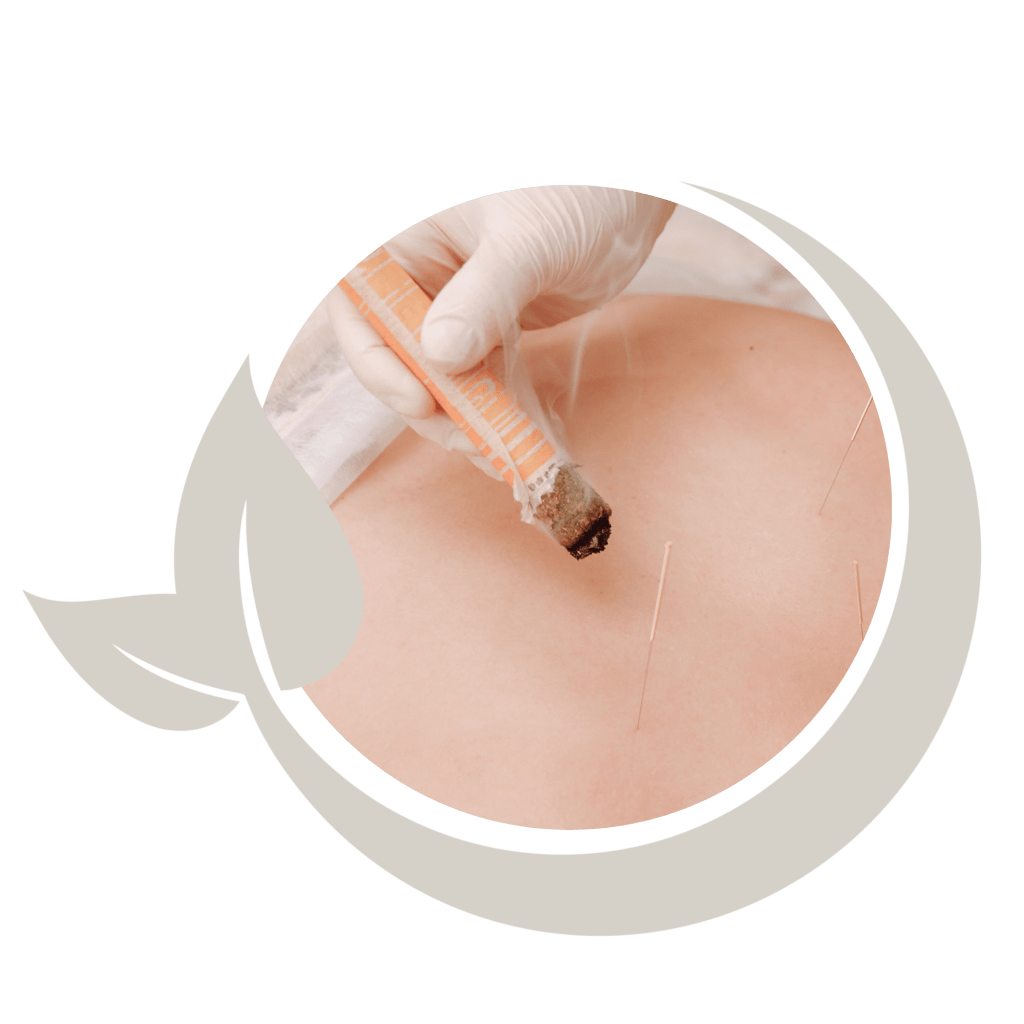 Moxibustión CERAGEM